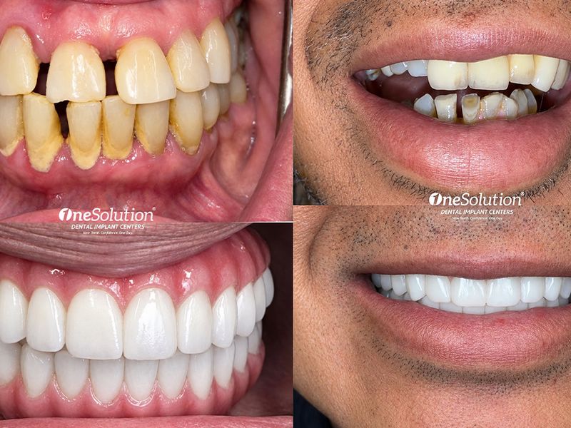 OneSolution Dental Implant Centers photo