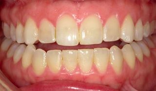 Dunwoody Dental