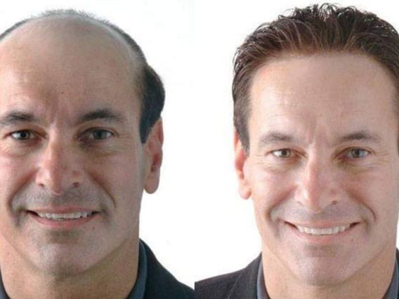 HCI Hair Solutions photo