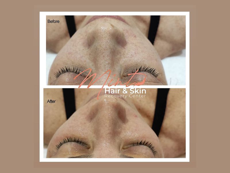 Mint Hair & Skin Recovery Center photo
