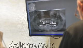 Bal Harbour Smiles