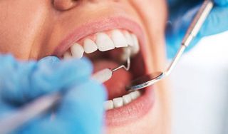 Ultra Smile Dentistry 