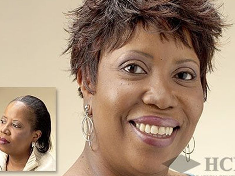 HCI Hair Solutions photo